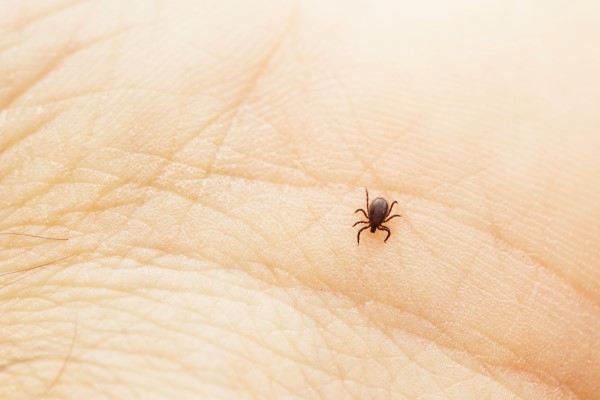 What to do if a tick bites you