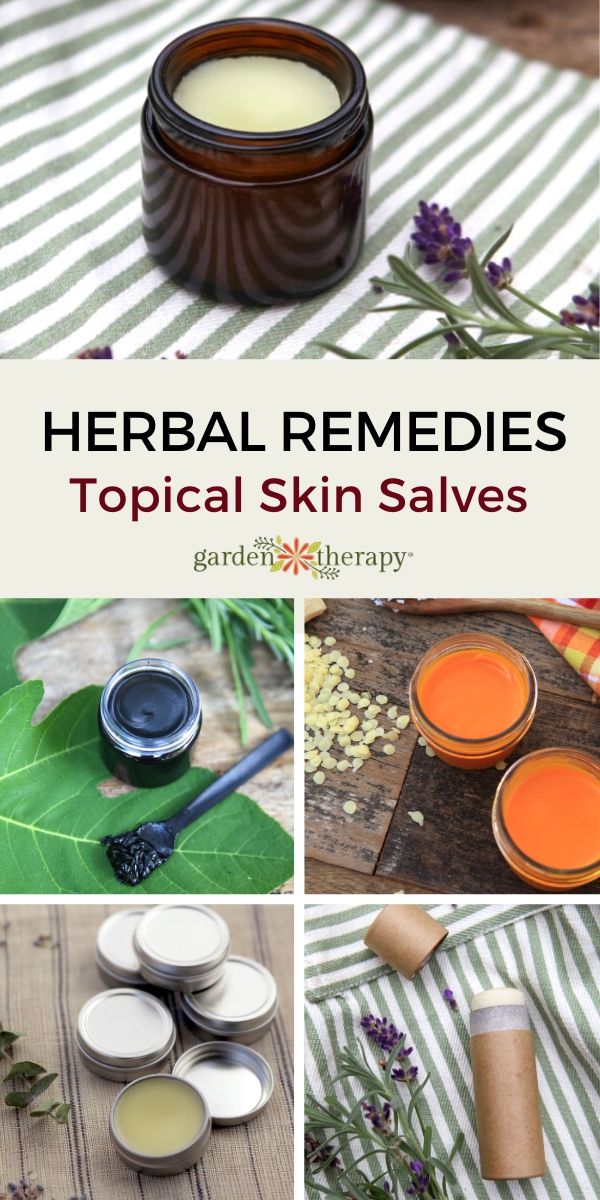 Herbal Topical Remedies