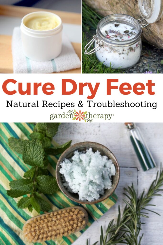 Pin image for how to cure dry feet including peppermint food scrub, epsom salts foot bath, and all-natural foot lotion.